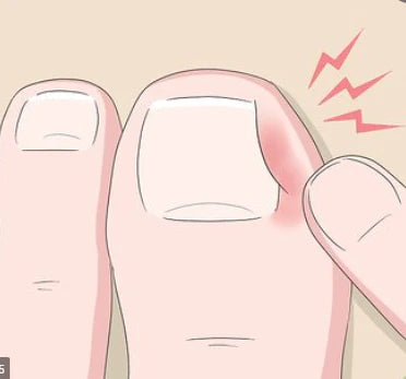 Alicate Para Desencravar Unhas | Clean Max + Kit Exclusivo 🎁